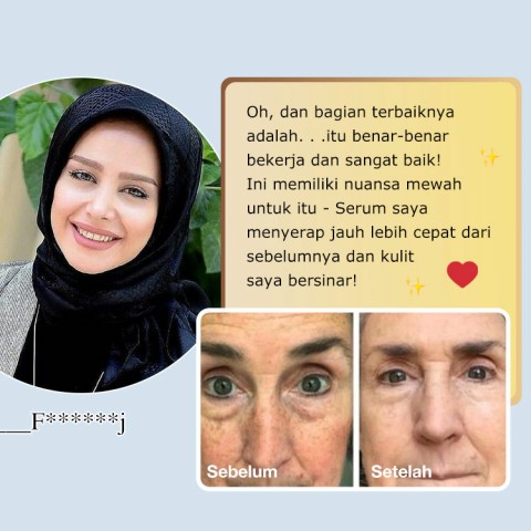 Perangkat perawatan kulit mata