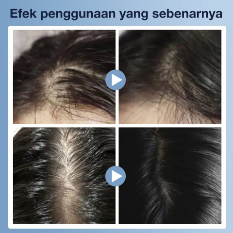 Beli satu dapat satu-Pijat Sisir Kesehatan Inframerah Pertumbuhan Rambut & Perawatan Rambut & Esensi Pertumbuhan Rambut