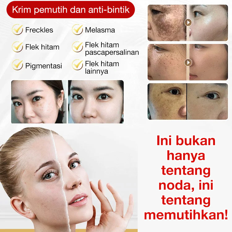 Promosi Idul Adha-Potongan kedua hanya 70 rb - Esensi pencerah spot - Ucapkan selamat tinggal pada semua bintik-bintik, bintik hitam, dan bintik matahari!	