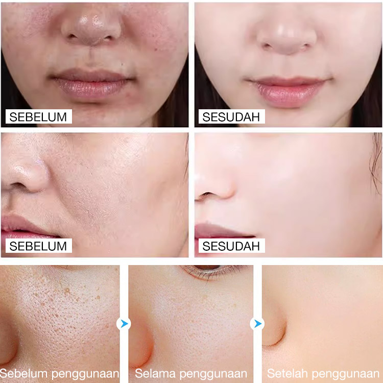 Promosi Idul Adha hemat 50K sekarang - Gel Pengelupas Enzim Pemurni-Saatnya mengucapkan selamat tinggal pada kulit kusam! Ucapkan Selamat Datang pada Kulit Halus dan Bercahaya!
