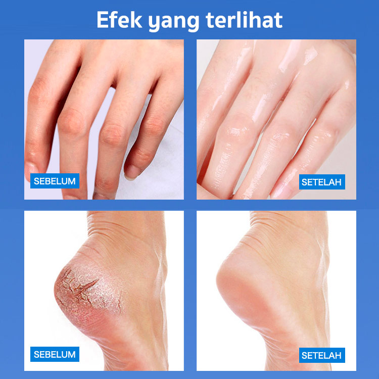 Penjual terbaik di Jepang-Stik Pelembab Vaseline Peach-Menghilangkan persendian tangan dan kaki yang pecah-pecah/terkelupas/hitam