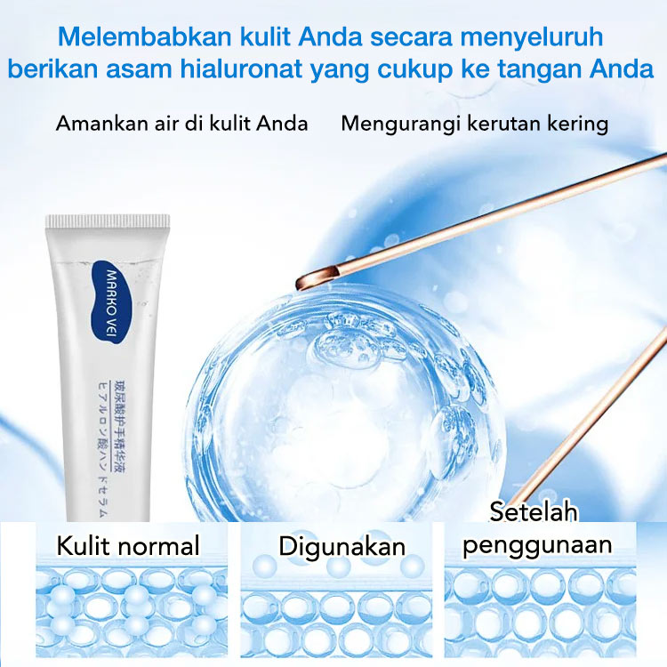 Beli 1 Dapat 1-Hyaluronic Acid Hand Serum-Menutrisi tangan dan menghilangkan Hangnail / mengupas / sendi gelap dengan mudah