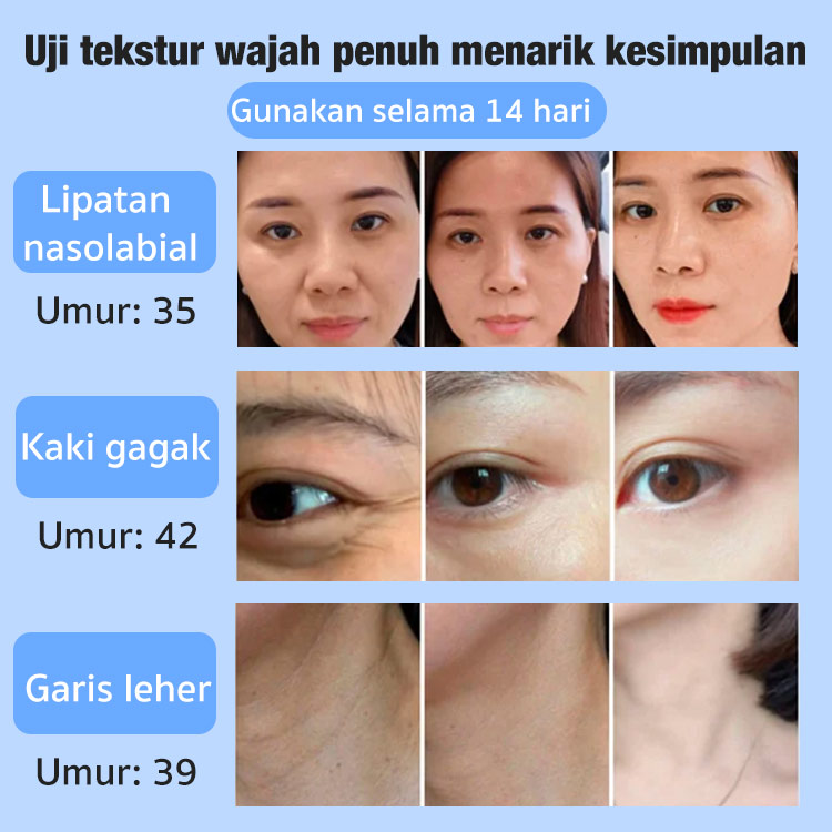 Beli satu gratis satu-Krim peremajaan anti keriput Jepang 28 hari-Direkomendasikan oleh dokter kulit dan dokter salon kecantikan--Sertifikasi BPOM-Halal