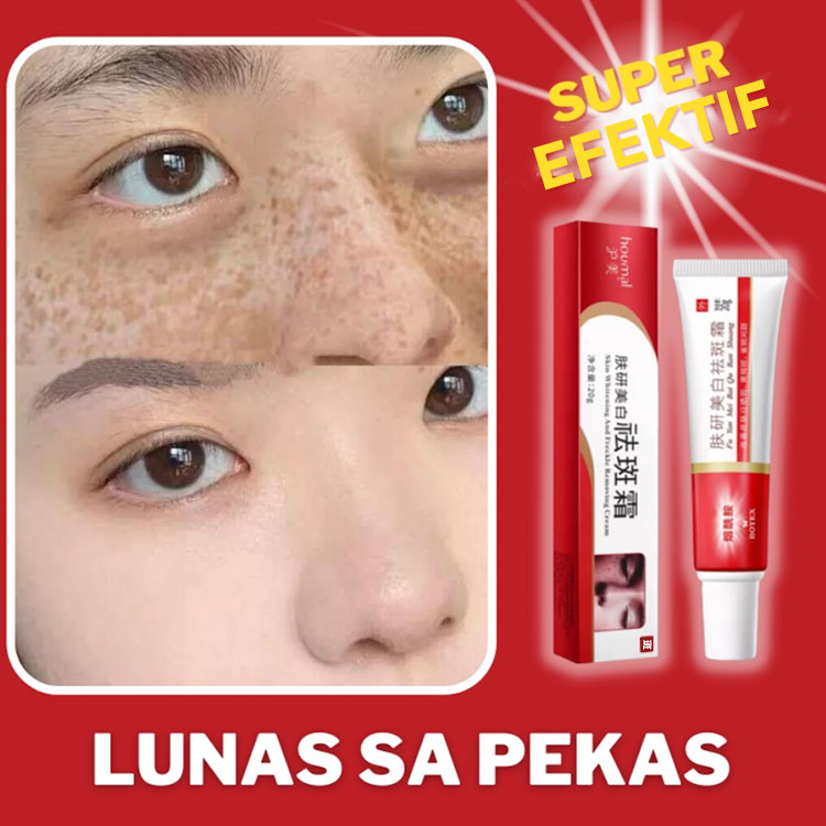 Beli 1 gratis 1 -Krim Bintik Niacinamide - Memudar Melasma / Bintik / Terbakar Sinar Matahari / Bintik-bintik Penuaan / Bintik Bercahaya